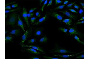 Immunofluorescence of purified MaxPab antibody to DNAJC30 on HeLa cell. (DNAJC30 antibody  (AA 1-226))