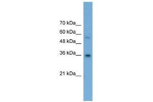 GALE antibody used at 0. (GALE antibody  (Middle Region))