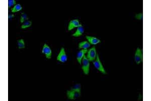 Immunofluorescence staining of Hela cells with ABIN7168827 at 1:133, counter-stained with DAPI. (SEMA6D antibody  (AA 913-1068))