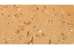 Immunohistochemistry of paraffin-embedded Human brain using CFHR1 Polyclonal Antibody at dilution of 1:40 (CFHR1 antibody)