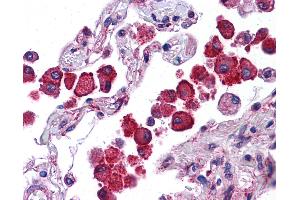 Anti-NLRP13 antibody IHC of human lung. (NLRP13 antibody  (N-Term))
