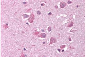 Brain, cortex (SIRT2 antibody  (N-Term))