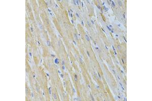 Immunohistochemistry of paraffin-embedded rat heart using NME1 Antibody (ABIN5970089) at dilution of 1/200 (40x lens).