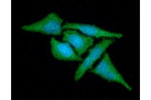 ICC/IF analysis of MAT2A in HeLa cells line, stained with DAPI (Blue) for nucleus staining and monoclonal anti-human MAT2A antibody (1:100) with goat anti-mouse IgG-Alexa fluor 488 conjugate (Green). (MAT2A antibody  (AA 1-395))
