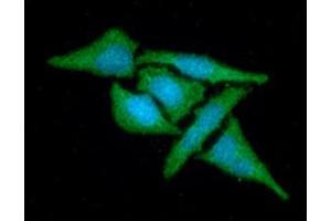 ICC/IF analysis of MAT2A in HeLa cells line, stained with DAPI (Blue) for nucleus staining and monoclonal anti-human MAT2A antibody (1:100) with goat anti-mouse IgG-Alexa fluor 488 conjugate (Green). (MAT2A antibody)