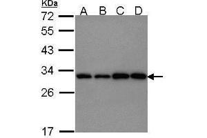 WB Image Sample (30 ug of whole cell lysate) A: 293T B: A431 , C: JurKat D: Raji 12% SDS PAGE antibody diluted at 1:1000 (PGAM1 antibody)