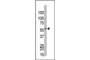 Western Blotting (WB) image for anti-Phosphatidylinositol 3-kinase regulatory subunit gamma (PIK3R3) (AA 324-353), (C-Term) antibody (ABIN360461) (PIK3R3 antibody  (C-Term))