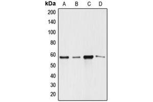 Western blot analysis of ANGPTL1 expression in SW620 (A), A549 (B), MCF7 (C), SGC (D) whole cell lysates. (ANGPTL1 antibody  (N-Term))