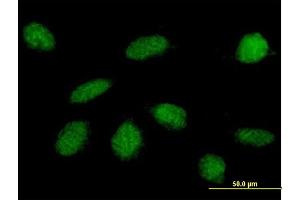 Immunofluorescence of purified MaxPab antibody to GLI4 on HeLa cell. (GLI4 antibody  (AA 1-376))