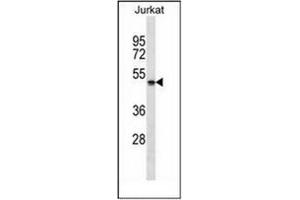 Western blot analysis of NBPF5 Antibody (C-term) in Jurkat cell line lysates (35ug/lane). (NBPF5 antibody  (C-Term))
