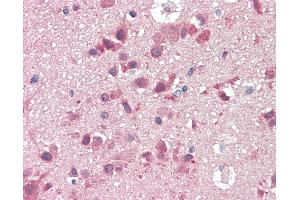 Anti-SLC38A2 / SNAT2 antibody IHC staining of human brain, cortex. (SLC38A2 antibody  (AA 35-84))