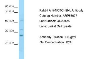 Western Blotting (WB) image for anti-Notch 2 N-terminal Like (NOTCH2NL) (C-Term) antibody (ABIN2786463)