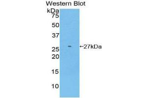 Western Blotting (WB) image for anti-Glutathione S-Transferase mu 2 (Muscle) (GSTM2) (AA 5-202) antibody (ABIN1859092) (GSTM2 antibody  (AA 5-202))