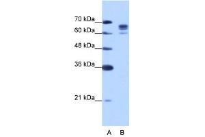 DDX17 antibody used at 1. (DDX17 antibody)