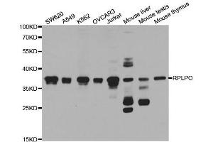 Western Blotting (WB) image for anti-Ribosomal Protein, Large, P0 (RPLP0) antibody (ABIN1876737) (RPLP0 antibody)