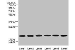 Western blot All lanes: SPATA19 antibody at 1 μg/mL Lane 1: MCF-7 whole cell lysate Lane 2: Hela whole cell lysate Lane 3: HepG2 whole cell lysate Lane 4: MDA-MB-231 whole cell lysate Lane 5: A549 whole cell lysate Lane 6: Mouse liver tissue Secondary Goat polyclonal to rabbit IgG at 1/10000 dilution Predicted band size: 20 kDa Observed band size: 20 kDa (SPATA19 antibody  (AA 25-167))