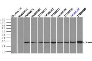 Image no. 4 for anti-Crystallin, alpha B (CRYAB) antibody (ABIN1497646) (CRYAB antibody)