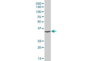 TSC22D3 polyclonal antibody (A01), Lot # 051018JC01. (TSC22D3 antibody  (AA 1-97))