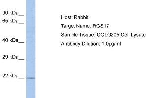Host: Rabbit Target Name: RGS17 Sample Tissue: Human COLO205 Whole Cell Antibody Dilution: 1ug/ml (RGS17 antibody  (C-Term))