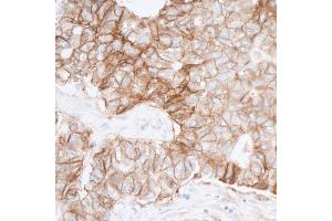 Immunohistochemistry (IHC) image for anti-Poliovirus Receptor (PVR) (AA 28-329) antibody (ABIN7449549)