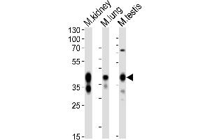 Western blot analysis of lysates from mouse kidney, mouse lung, mouse testis tissue lysate (from left to right), using Epcam Antibody (C-term) (ABIN6242229 and ABIN6577822). (EpCAM antibody  (C-Term))