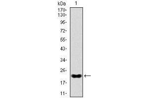 Western blot analysis using NKX2. (Nkx2-2 antibody)