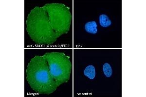 (ABIN185267) Immunofluorescence analysis of paraformaldehyde fixed U2OS cells, permeabilized with 0. (FTCD antibody  (N-Term))