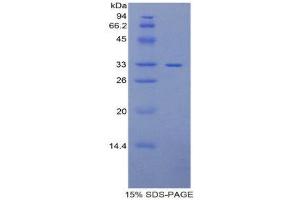 SDS-PAGE (SDS) image for Pitrilysin Metallopeptidase 1 (PITRM1) (AA 653-926) protein (His tag) (ABIN2121894)