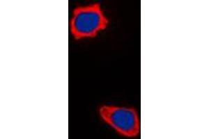 Immunofluorescent analysis of COX17 staining in HepG2 cells. (COX17 antibody  (N-Term))
