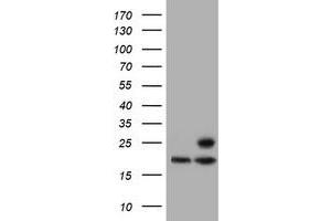 PSMB9 anticorps  (AA 21-219)