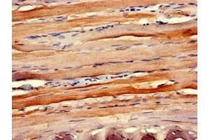 Immunohistochemistry of paraffin-embedded human skeletal muscle tissue using ABIN7145918 at dilution of 1:100 (CCR1 antibody  (AA 314-362))