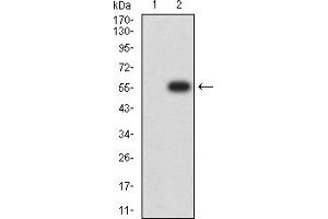Western blot analysis using CHRNB2 mAb against HEK293 (1) and CHRNB2 (AA: extra 26-233)-hIgGFc transfected HEK293 (2) cell lysate. (CHRNB2 antibody  (AA 26-233))