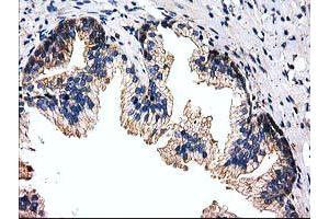 Immunohistochemical staining of paraffin-embedded Human prostate tissue using anti-FAM40A mouse monoclonal antibody. (STRIP1 antibody)