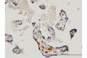 Immunoperoxidase of monoclonal antibody to MKNK1 on formalin-fixed paraffin-embedded human placenta. (MKNK1 antibody  (AA 1-465))