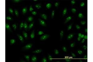 Immunofluorescence of monoclonal antibody to RNU3IP2 on HeLa cell. (RRP9 antibody  (AA 1-475))