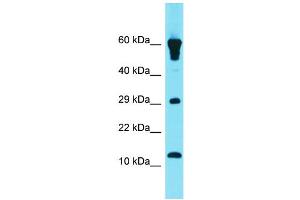 Host: Rabbit Target Name: GCSAML Sample Type: Fetal Heart lysates Antibody Dilution: 1. (GCSAML antibody  (N-Term))