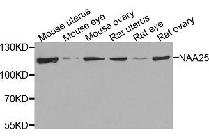 Western blot analysis of extracts of various cells, using NAA25 antibody. (NAA25 antibody)