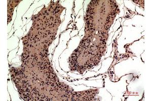 Immunohistochemistry (IHC) image for anti-High Mobility Group Box 1 (HMGB1) (Internal Region) antibody (ABIN6287398)