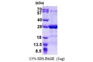 SDS-PAGE (SDS) image for Synaptosomal-Associated Protein, 25kDa (SNAP25) protein (His tag) (ABIN666858)