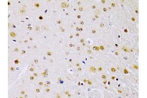 Immunohistochemistry of paraffin-embedded mouse brain using IKKβ antibody (ABIN3022875, ABIN3022876, ABIN3022877 and ABIN6219275) at dilution of 1:100 (40x lens). (IKBKB antibody  (AA 630-730))