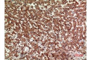 Immunohistochemistry (IHC) image for anti-Prostaglandin D2 Receptor 2 (PTGDR2) (Internal Region) antibody (ABIN6281468)