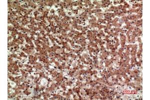 Immunohistochemistry (IHC) analysis of paraffin-embedded Human Liver, antibody was diluted at 1:100. (Prostaglandin D2 Receptor 2 (PTGDR2) (Internal Region) antibody)