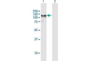 Western Blot analysis of HIP1R expression in transfected 293T cell line by HIP1R MaxPab polyclonal antibody. (HIP1R antibody  (AA 1-1068))