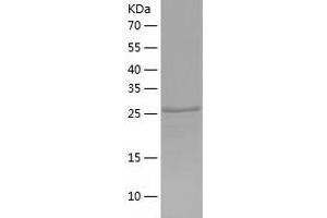 Western Blotting (WB) image for Major Histocompatibility Complex, Class I, B (HLA-B) (AA 25-308) protein (His tag) (ABIN7123829) (HLA-B Protein (AA 25-308) (His tag))