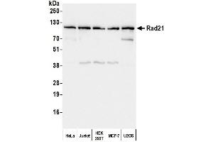 Western Blotting (WB) image for anti-RAD21 Homolog (RAD21) (C-Term) antibody (ABIN7458039) (RAD21 antibody  (C-Term))
