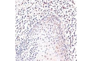 Immunohistochemistry (IHC) image for anti-Jun Proto-Oncogene (JUN) (AA 1-70) antibody (ABIN6142670)