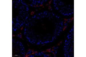 Immunohistochemistry (Paraffin-embedded Sections) (IHC (p)) image for anti-Testis-Specific Kinase 1 (TESK1) antibody (ABIN7075866)