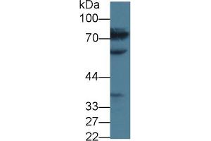 Detection of MTHFR in Human Jurkat cell lysate using Polyclonal Antibody to Methylenetetrahydrofolate Reductase (MTHFR) (MTHFR antibody  (AA 1-325))