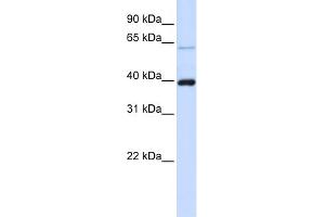 WB Suggested Anti-PHF6 Antibody Titration:  0. (PHF6 antibody  (C-Term))