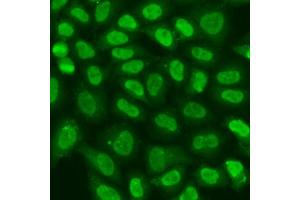 Immunofluorescence analysis of U2OS cells using TERF2IP antibody  at dilution of 1:100. (RAP1 antibody  (AA 1-280))